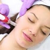 Microneedling Glow Series 20% off at Alchemy Skin Lab in Tualatin, OR