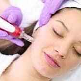 Microneedling & Exosomes 20% off at Alchemy Skin Lab in Tualatin, OR